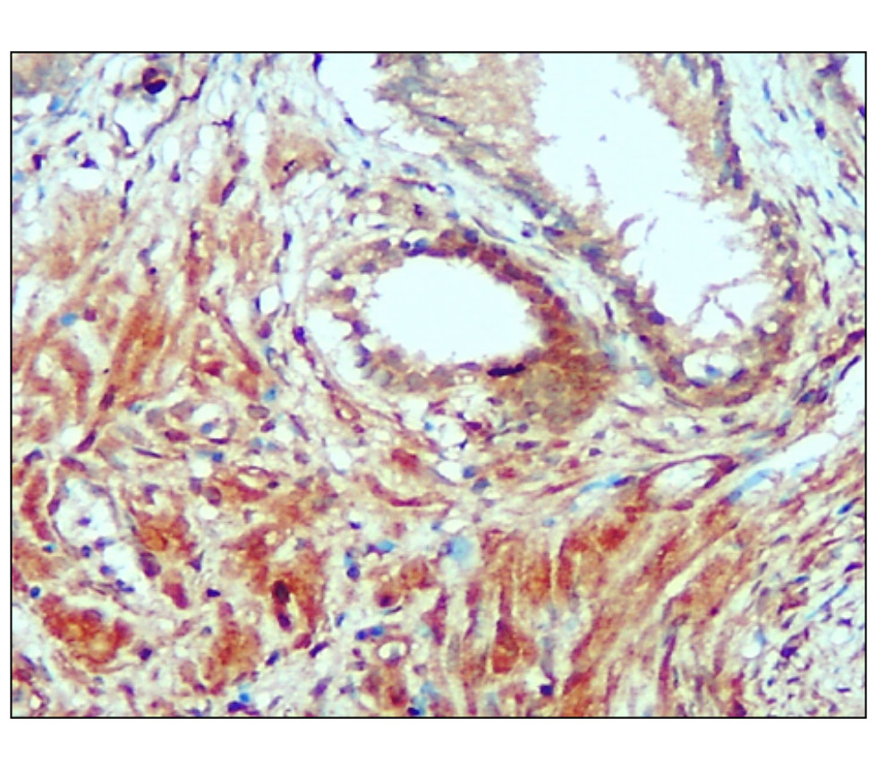 PERK/EIF2AK3 Antibody