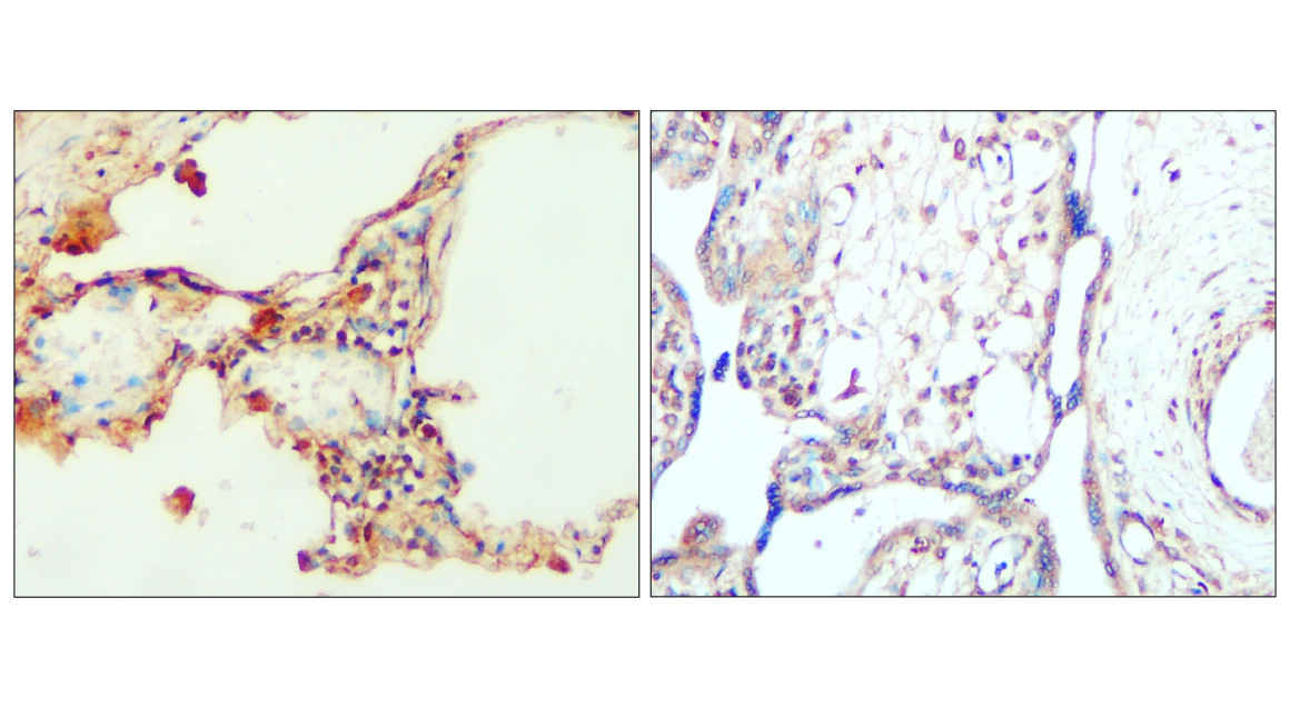 PERK/EIF2AK3 Antibody