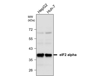 eIF2α Rabbit Polyclonal Antibody