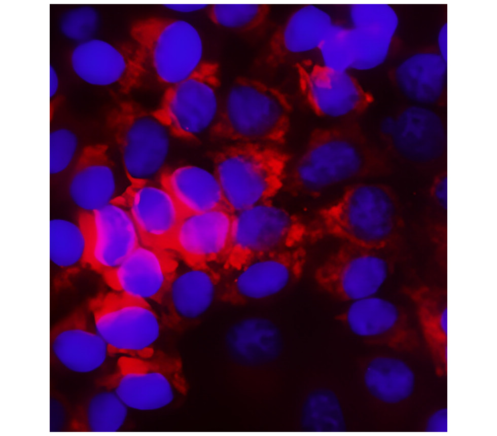 eIF2α / EIF2S1