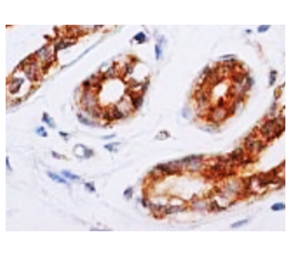 eIF2α / EIF2S1
