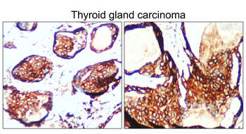 BiP Rabbit Polyclonal Antibody