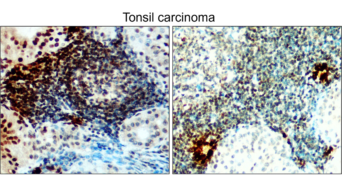 IRE1 alpha antibody