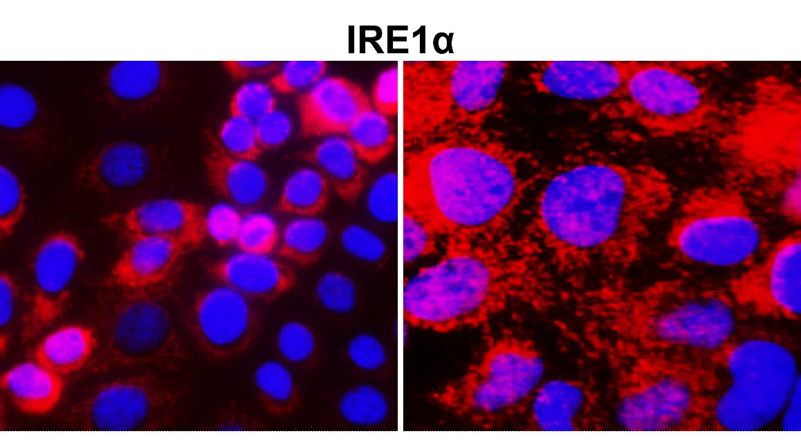 IRE1 alpha antibody