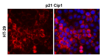p21 Waf1 Rabbit Polyclonal Antibody