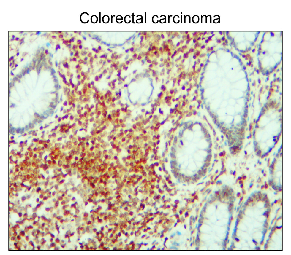 p21 Waf1/Cip1 Antibody