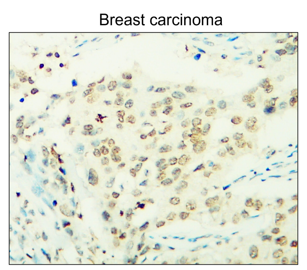 p21 Waf1/Cip1 Antibody