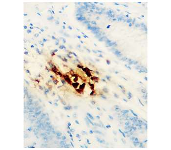 Cyclin E1 Rabbit Polyclonal Antibody