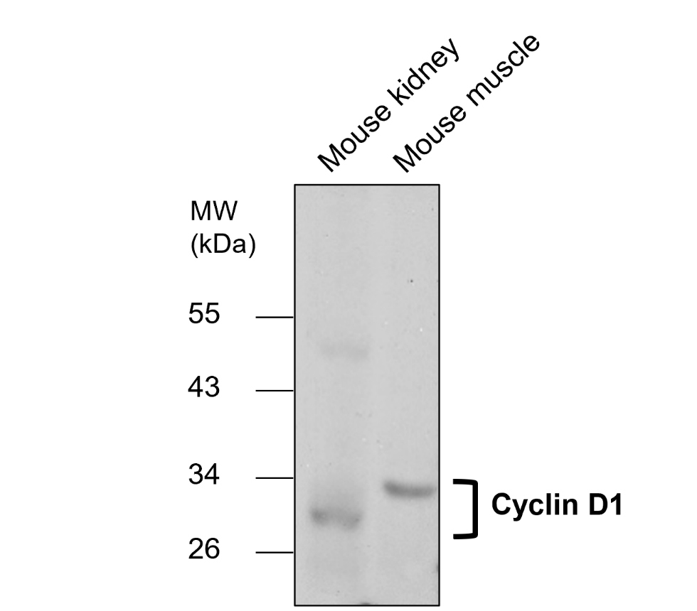 Cyclin D1 Antibody
