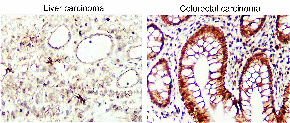 Cyclin D1 Antibody