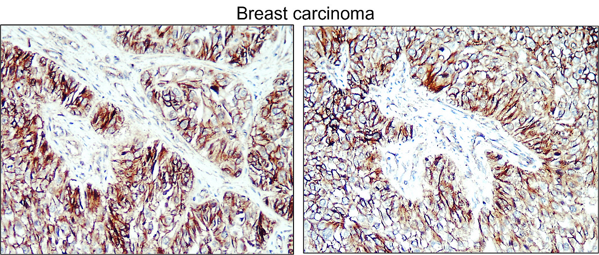 Cyclin D1 Antibody