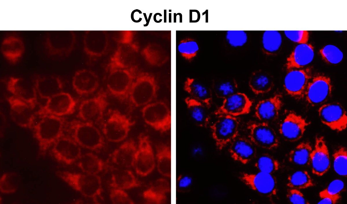 Cyclin D1 Antibody