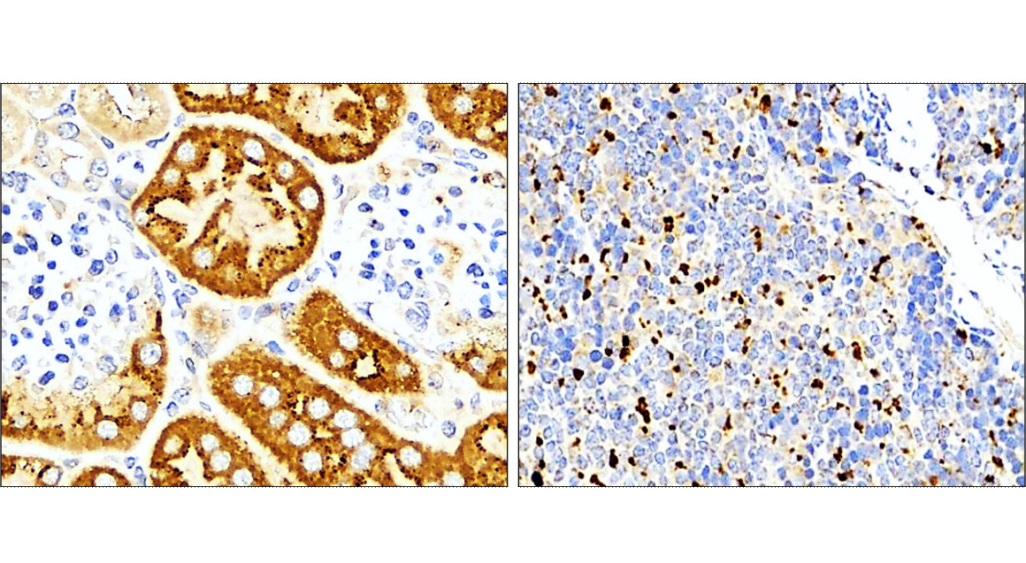 IL-1 beta Antibody