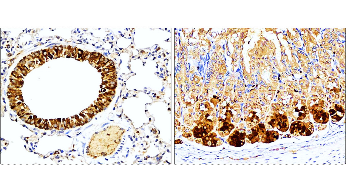 IL-1 beta Antibody