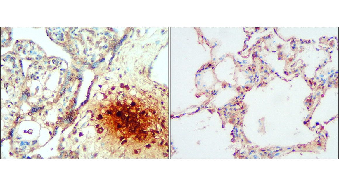 IL-1 beta Antibody