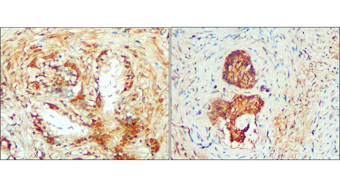 IL-1 beta Antibody