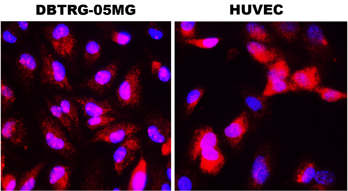 IL-1 beta Antibody