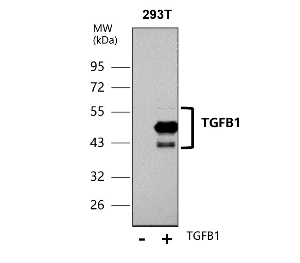 TGF beta 1 Antibody