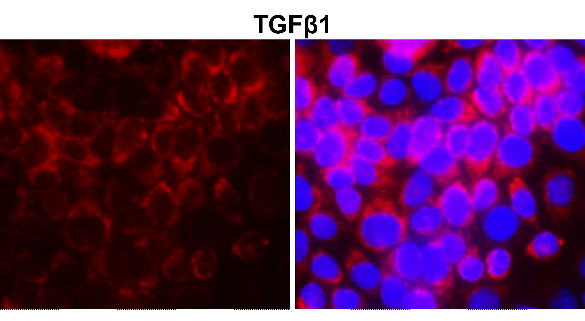 TGF beta 1 Antibody