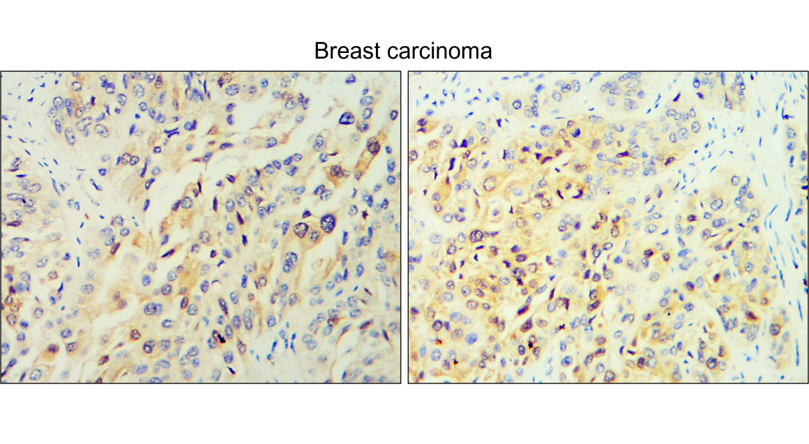 TGF beta 1 Antibody