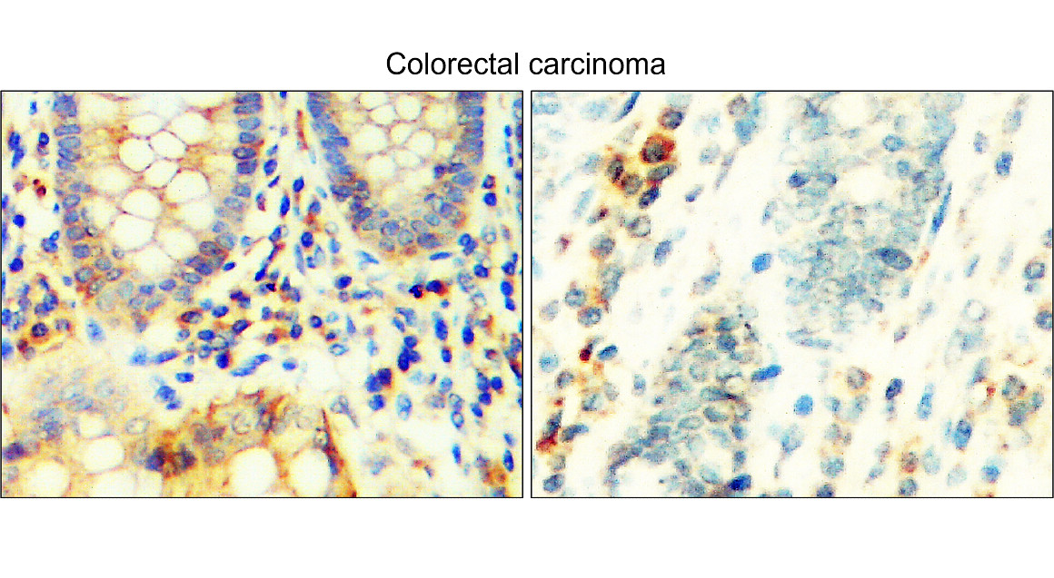 TGF beta 1 Antibody