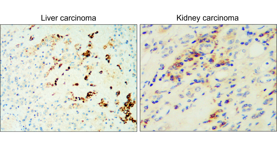 TGF beta 1 Antibody