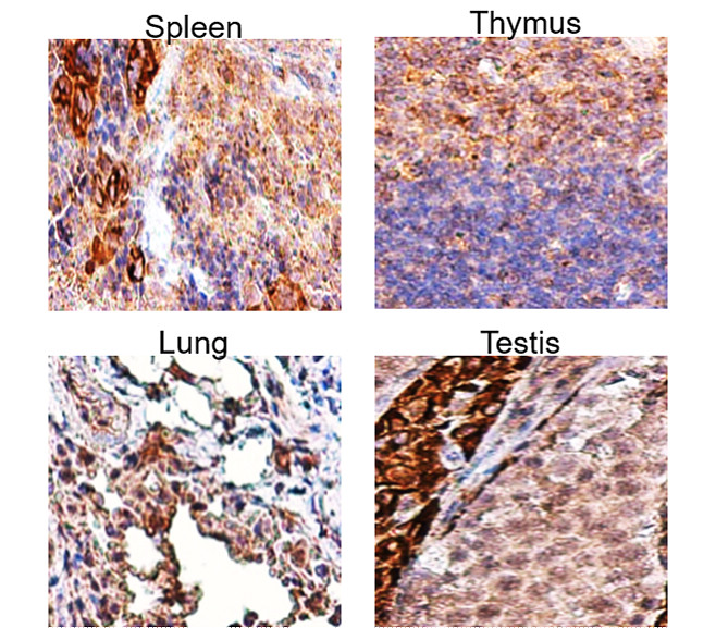 TGF beta 1 Antibody