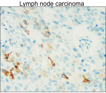 COX2/PTGS2 Antibody