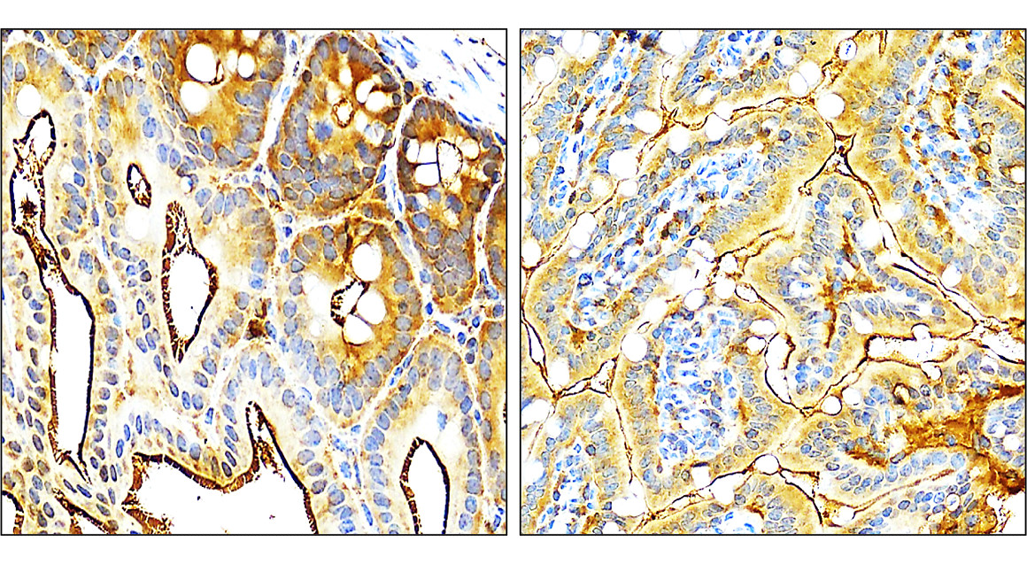 VEGF Antibody