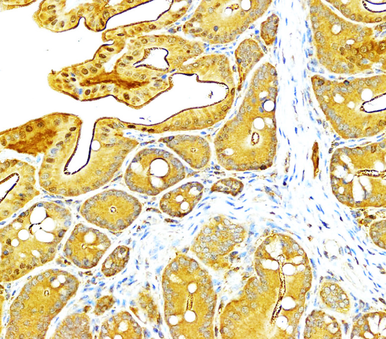 VEGF Antibody