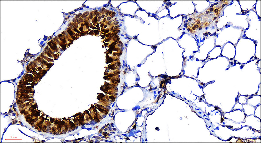 VEGF Antibody