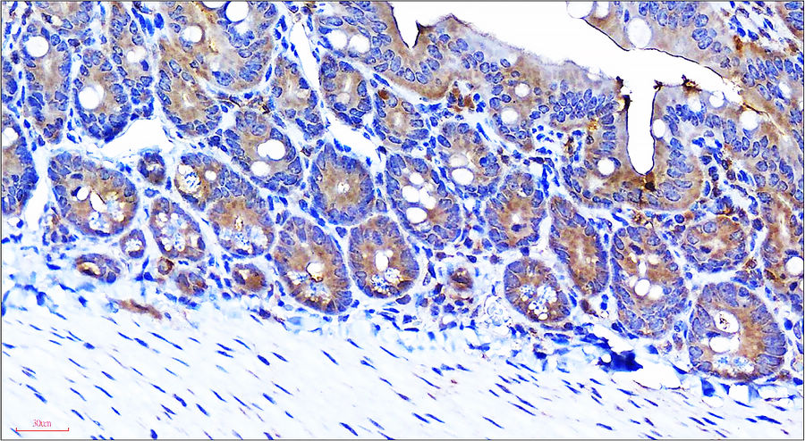 VEGF Antibody