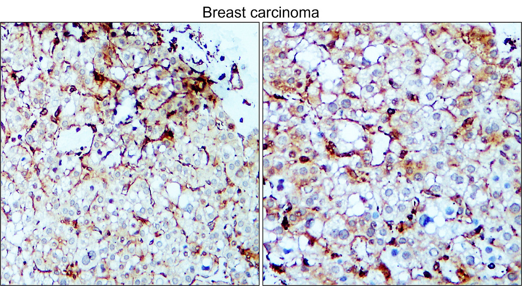 VEGF Antibody