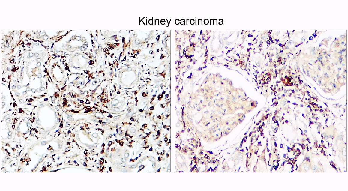 VEGF Antibody