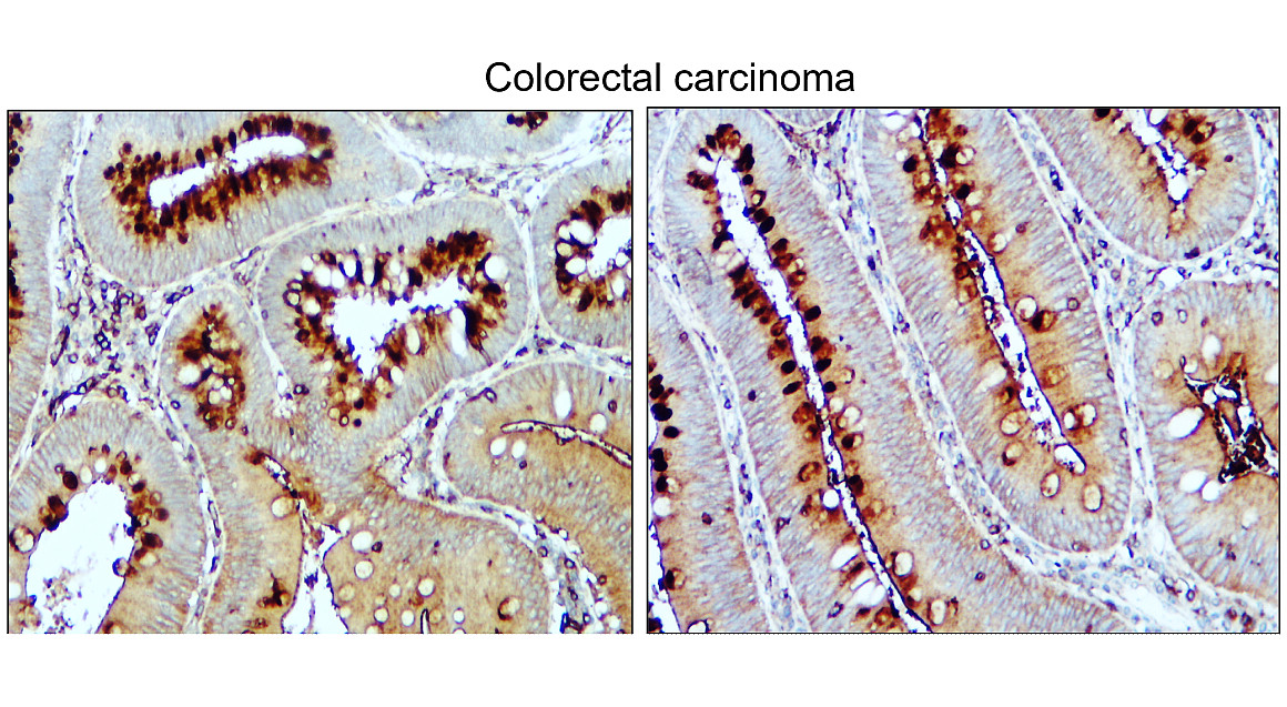 VEGF Antibody