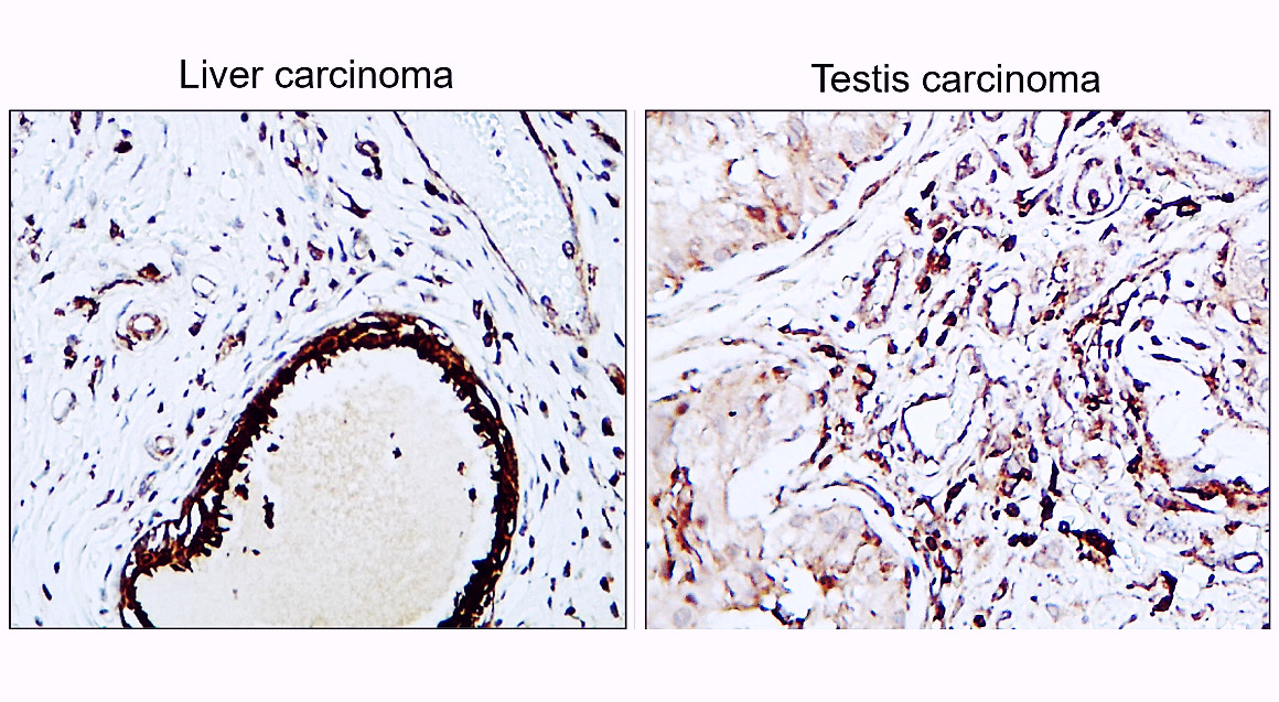 VEGF Antibody