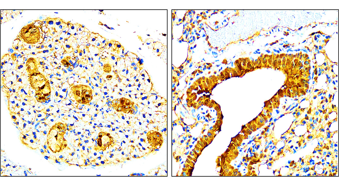 VEGF Antibody