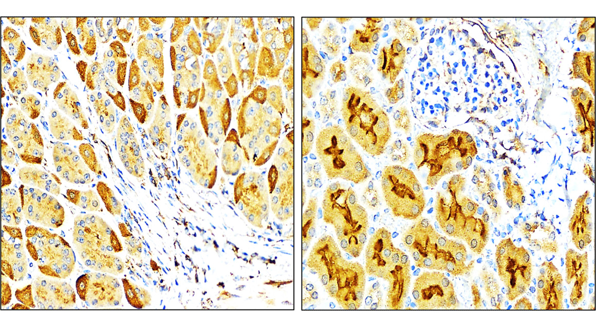 VEGF Antibody