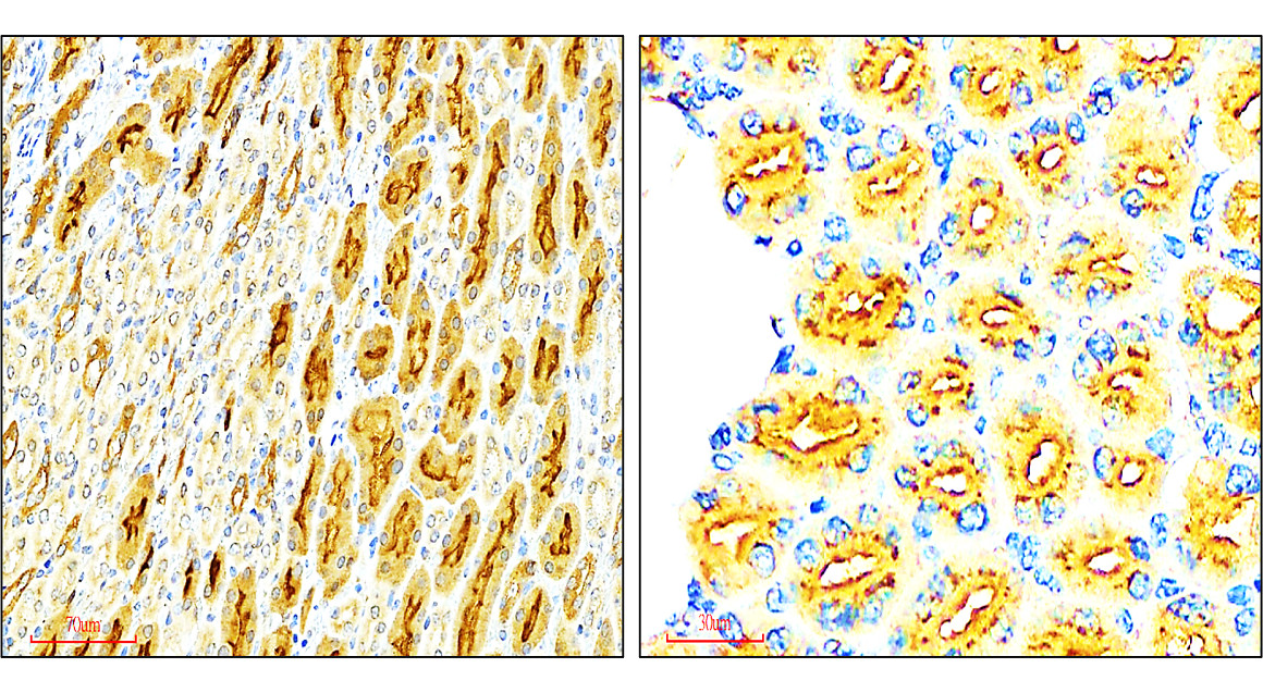 VEGF Antibody