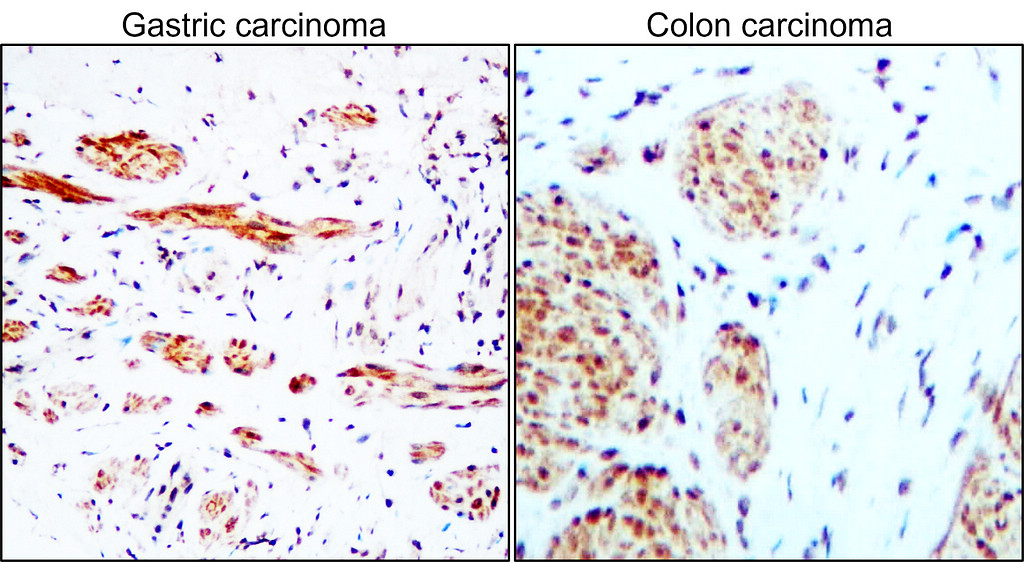 PARP1 Antibody