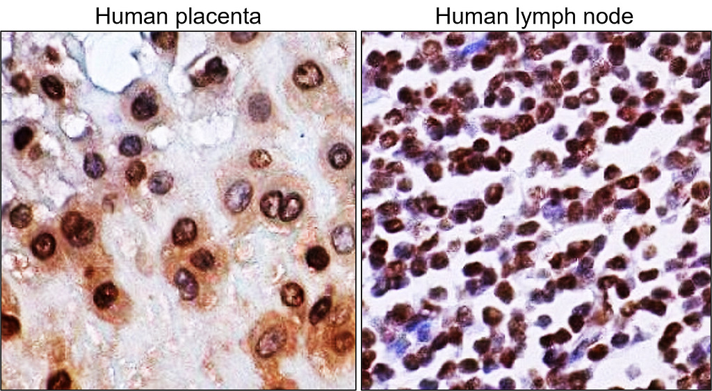 PARP1 Antibody