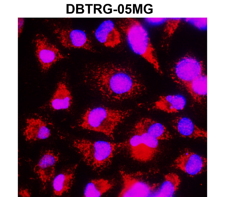 cleaved PARP Asp214 Antibody