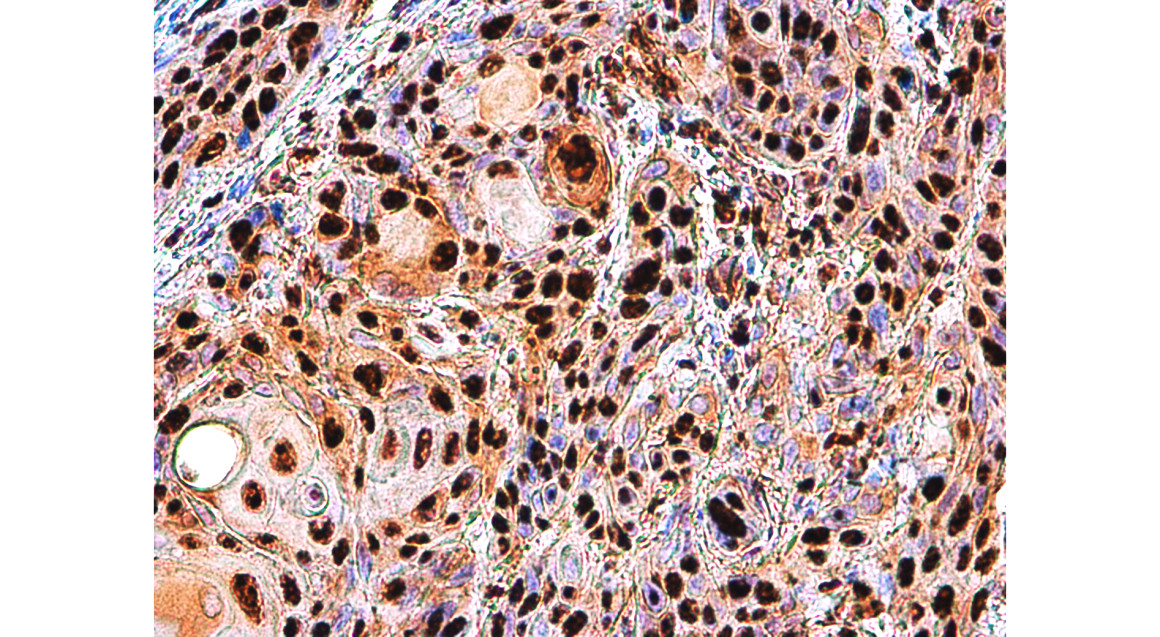 cleaved PARP Asp214 Antibody