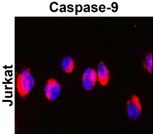 Caspase-9 cleaved Asp315 Antibody