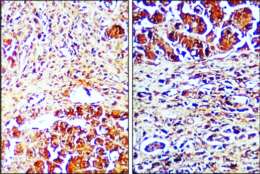 Caspase-8 Cleaved