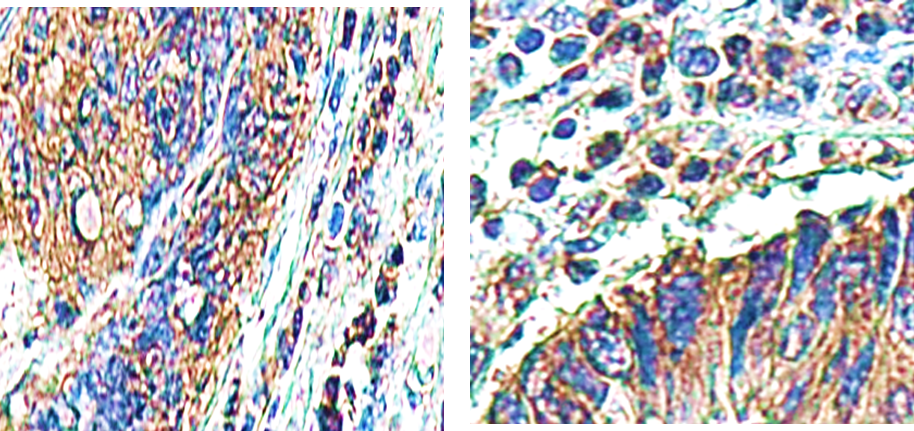 Caspase-8 Cleaved