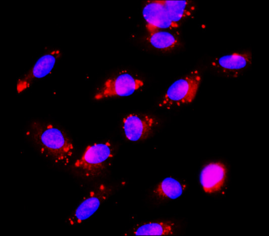 Caspase-8 Cleaved