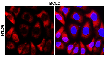 BCL2 Rabbit Polyclonal Antibody