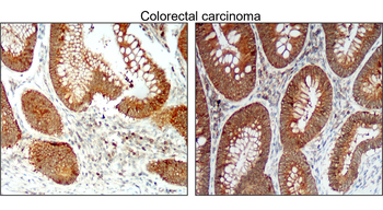 BCL2 Rabbit Polyclonal Antibody
