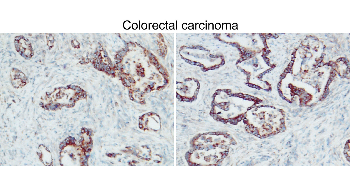 BAX Antibody